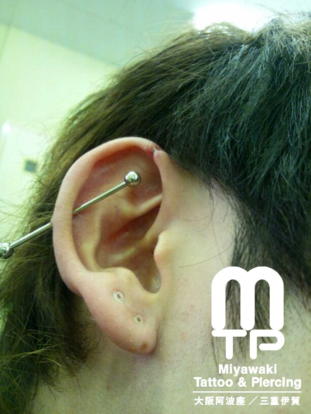 右耳のインダストリアルピアスの顔寄りの部分の排除。