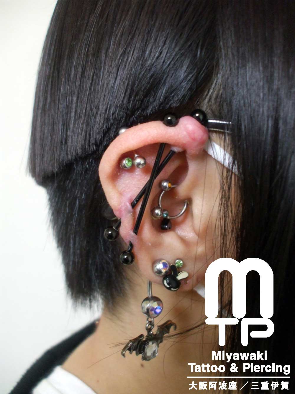 右耳のインダストリアルピアスに出来た大きな肉芽。