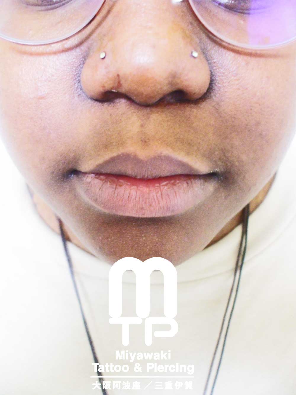 部位及び名称　左右の小鼻にノストリル