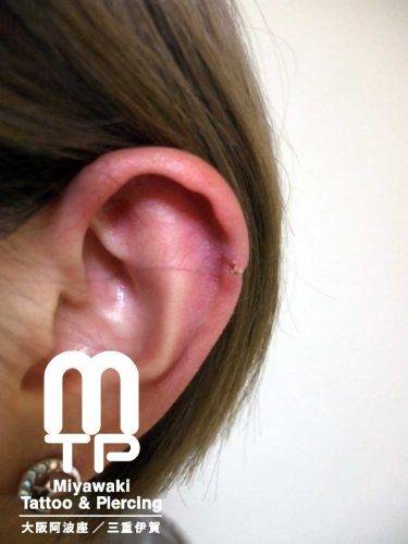 右耳のインダストリアルピアスの後ろ側の排除。