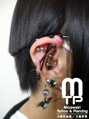 右耳のインダストリアルピアスに出来た大きな肉芽。