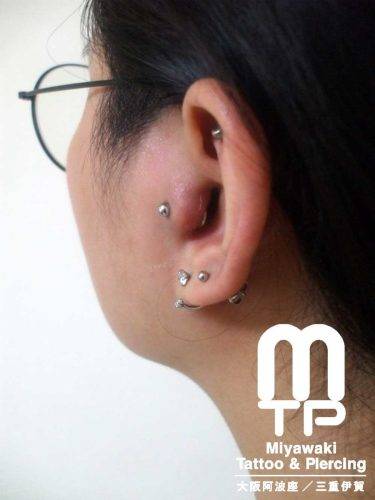 左耳のトラガスピアスが赤く腫れた状態。