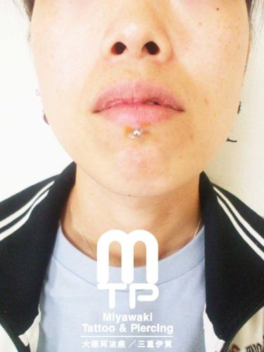 ピアスの部位及び名称　目立たないように透明のキャッチを使用した下唇中央のラブレットピアス