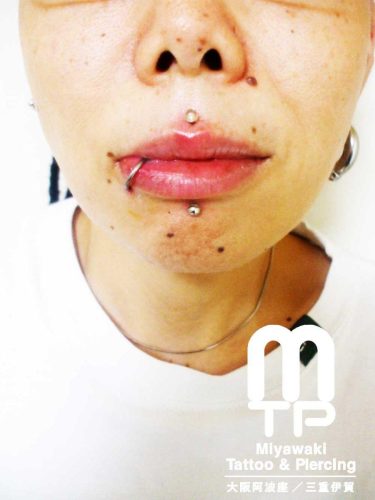 ピアスの部位及び名称　人中にメデューサピアス、下唇中央にラブレットピアス、下唇右端にリングジュエリーでのリップピアス