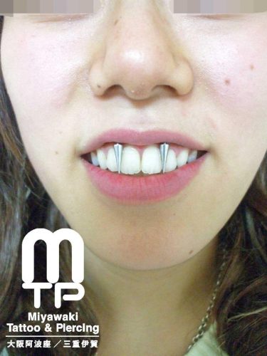 スクランパーへのピアッシンッグ後にジュエリー交換。三重県伊賀市のMiyawaki Tattoo＆Piercing