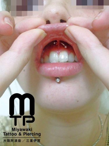 カーブドバーベルを使用してのスクランパーピアッシング。大阪市阿波座と三重県伊賀市のみやわきタトゥー＆ピアッシンッグ