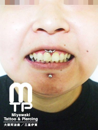 リングジュエリーでのスクランパーピアッシング。三重県伊賀市のMiyawaki Tattoo＆Piercing
