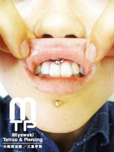 リングジュエリーを使用したスクランパーピアッシング。大阪市阿波座と三重県伊賀市のMiyawaki Tattoo＆Piercing