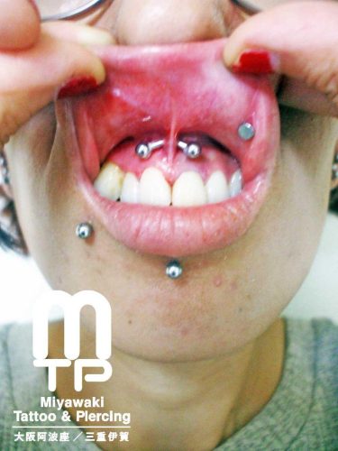 カーブドバーベルを使用したスクランパーピアッシング。大阪市阿波座のMiyawaki Tattoo＆Piercing
