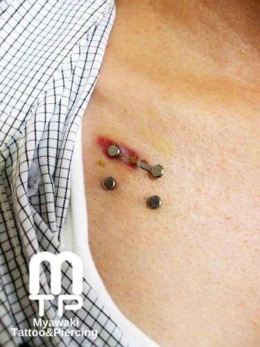 チェストの排除。