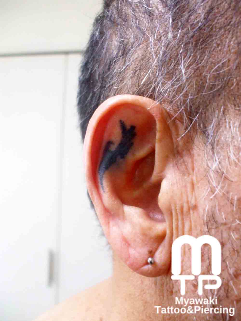 耳の表面に４０年前に施術したタトゥー